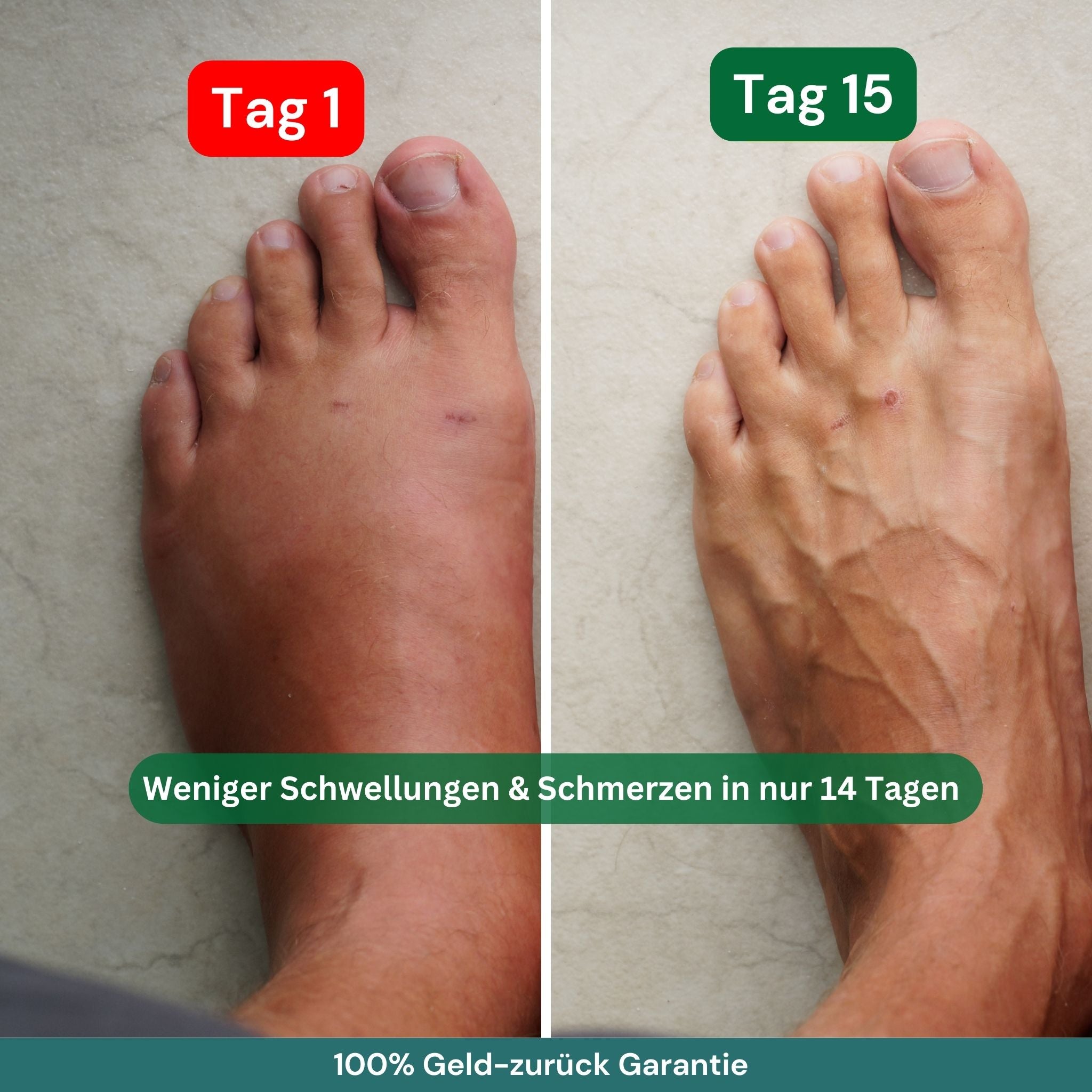 popyy® Kompressionsstrümpfe für schwere, schmerzende Beine