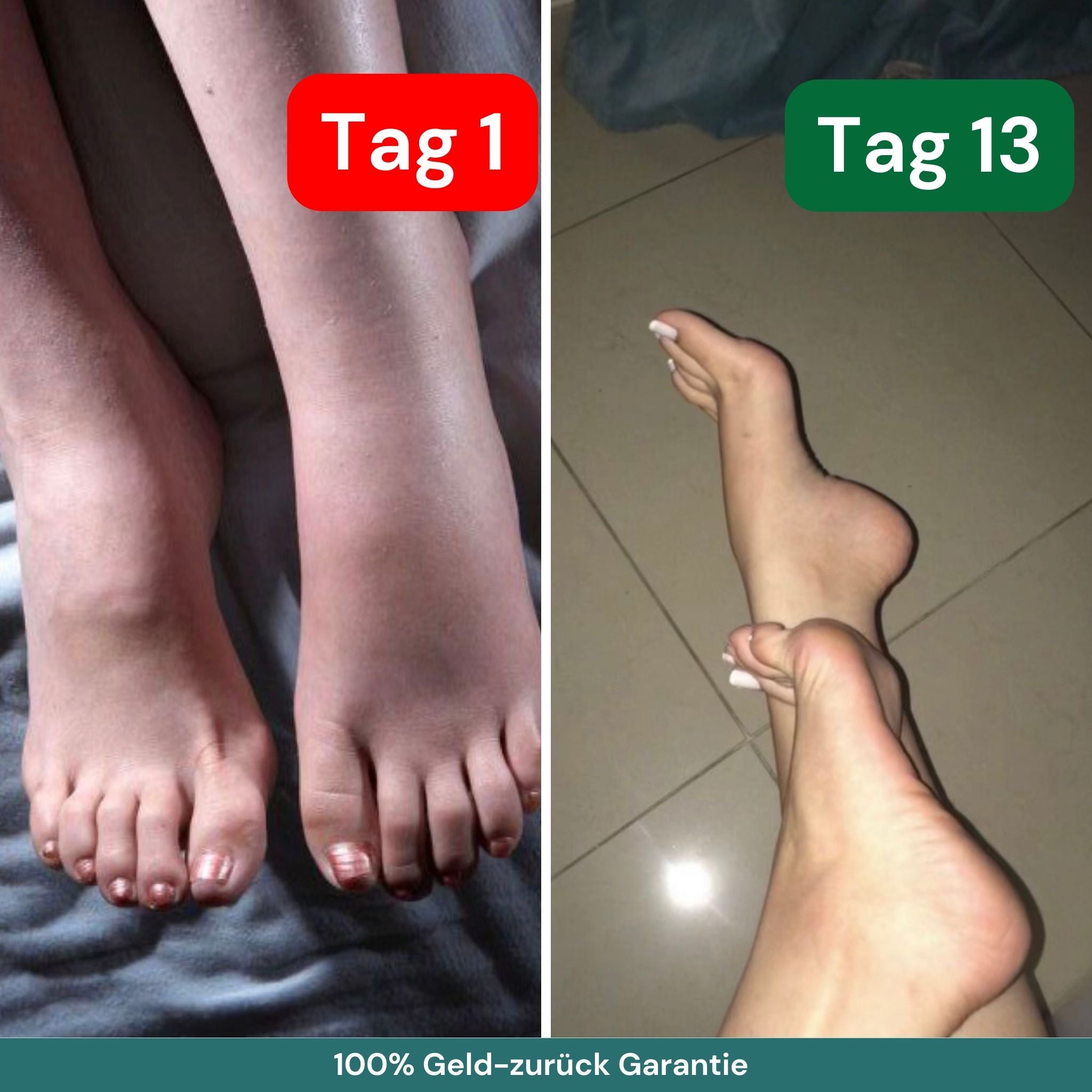 Kompressionsstrümpfe für schmerzfreie Beine und Füße, Grün