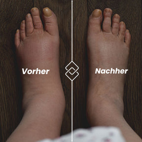 popyy Kompressionsstrümpfe für schwere, schmerzende Beine